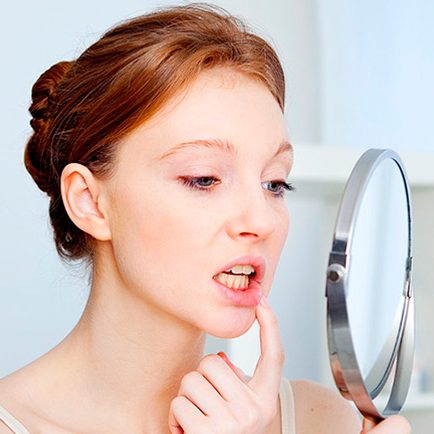Enfermedad de las encías periodontitis
