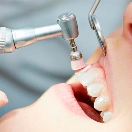 Tratamiento limpieza dental en Arrasate